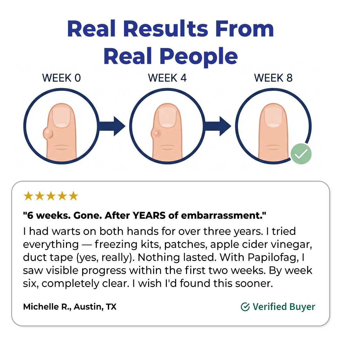Papilofag - Wart Remover