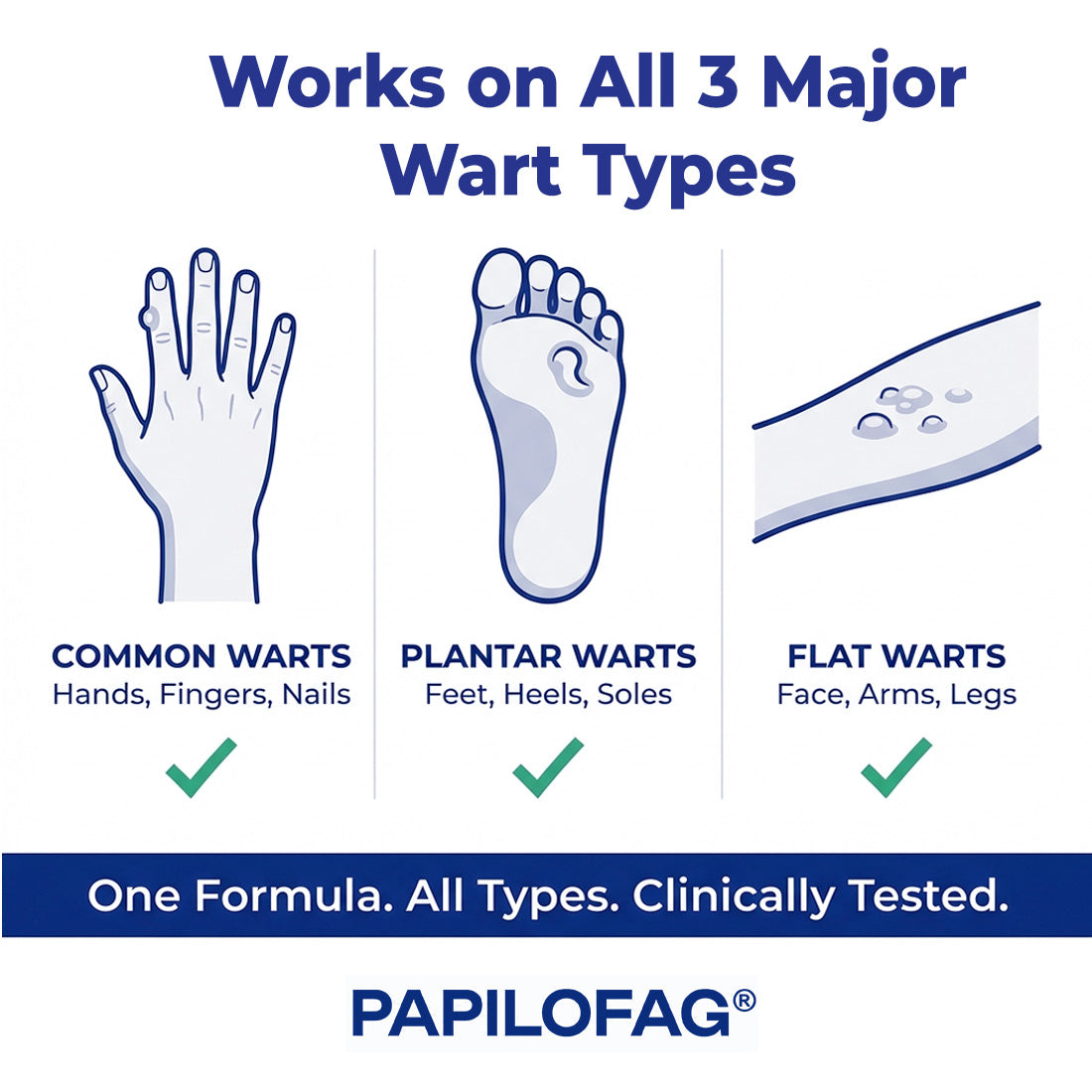 Papilofag - Wart Remover